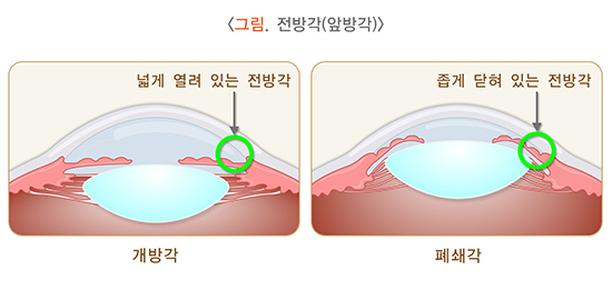 그림 전방각(앞방각)