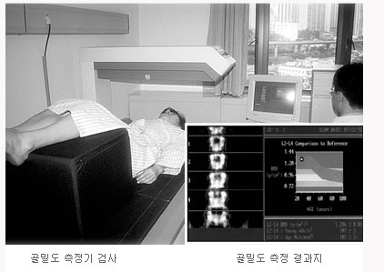 조기 진단의 중요성과 방법