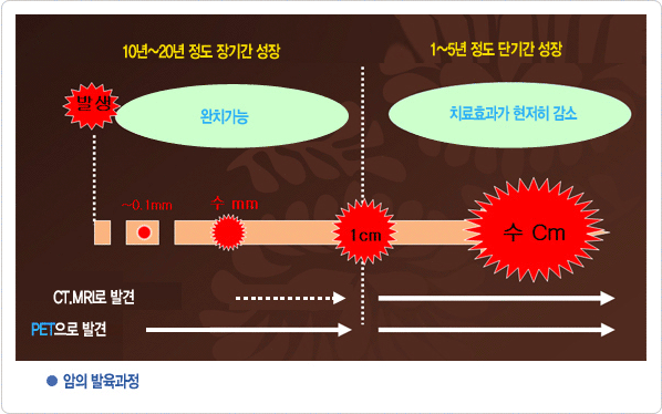 암의 발육과정