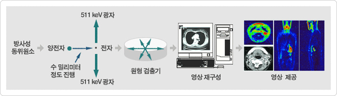 pet-ct 원리